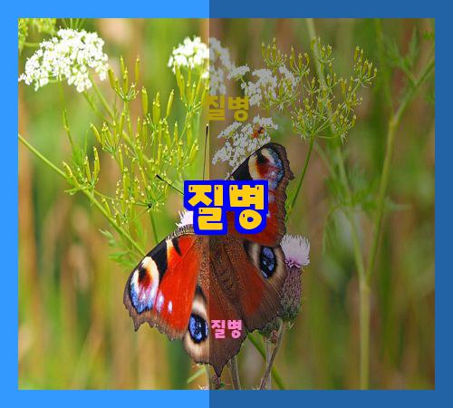 질병